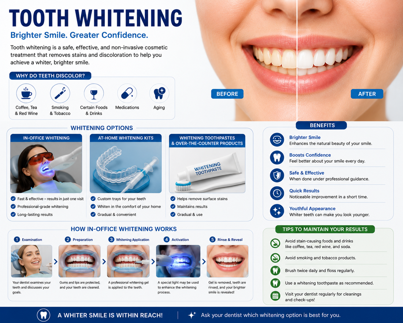 TOOTH WHITENING