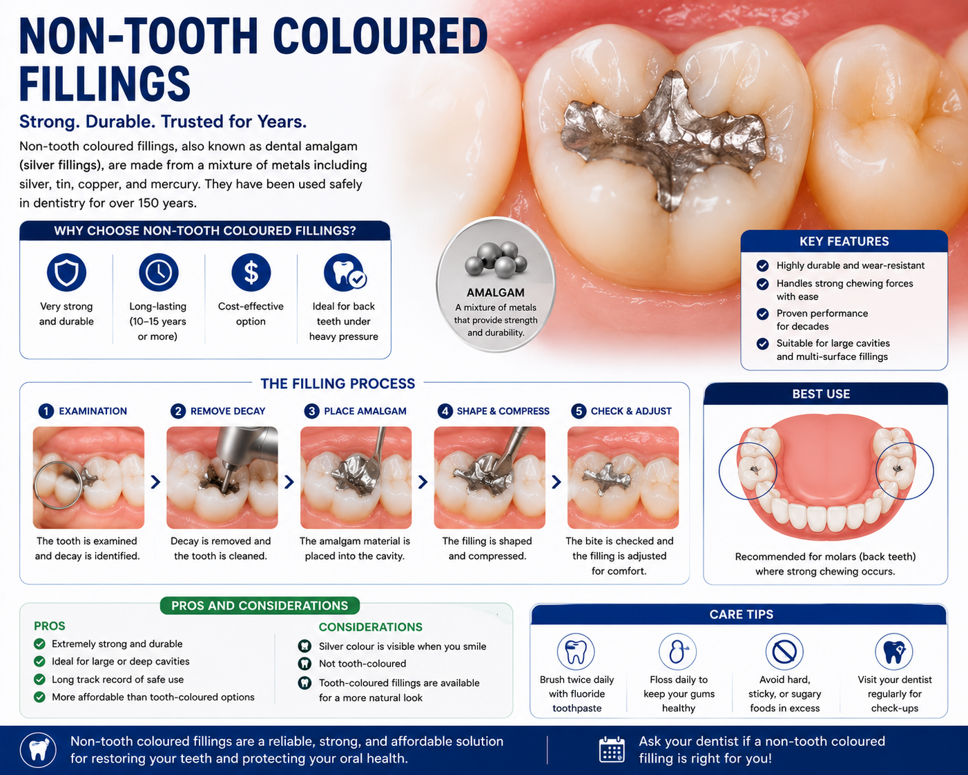 NON TOOTH COLOURED FILLING