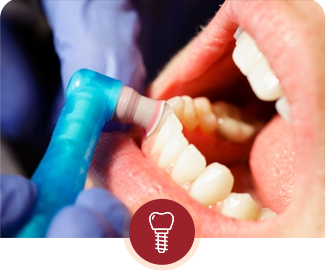 TOOTH CLEANING
